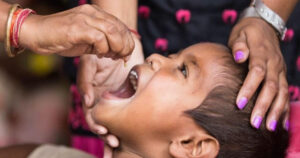 बाइस लाख बालबालिकालाई भिटामिन ‘ए’ खुवाइँदै