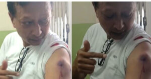 जेनजी प्रदर्शन: कान्तिपुर टिभीका पत्रकार श्रेष्ठलाई गोली लाग्यो